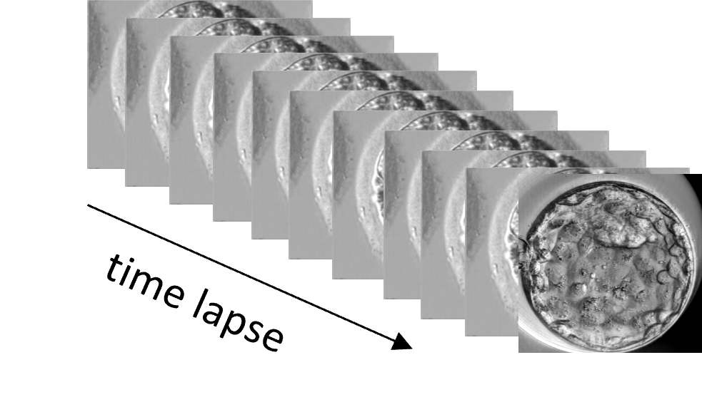 정량화된 데이터